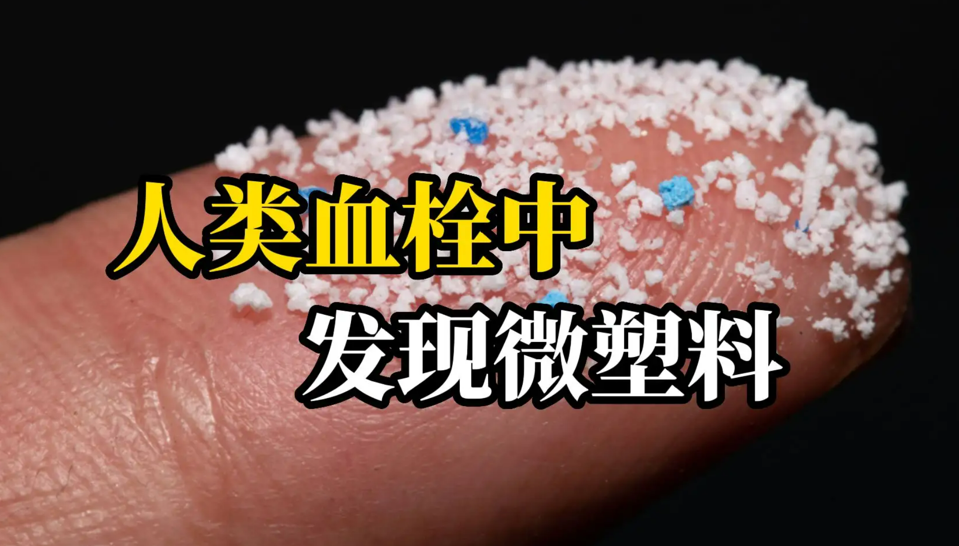 震驚！人類血栓中首次發(fā)現(xiàn)微塑料！